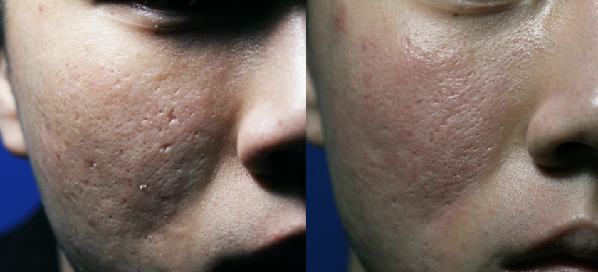 제목 없음-1 사본.JPG