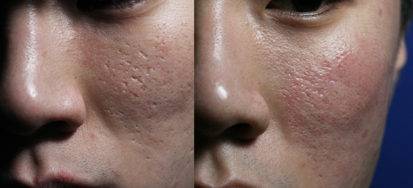 제목 없음-5 사본.JPG