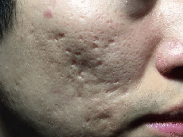 오른쪽_치료전 움짤.gif