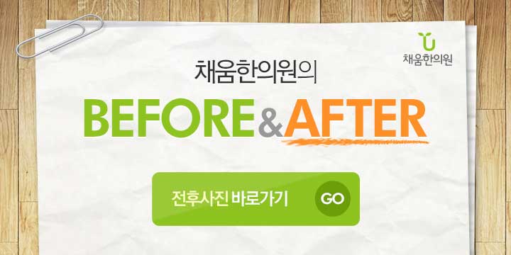 치료 전후사진 바로가기